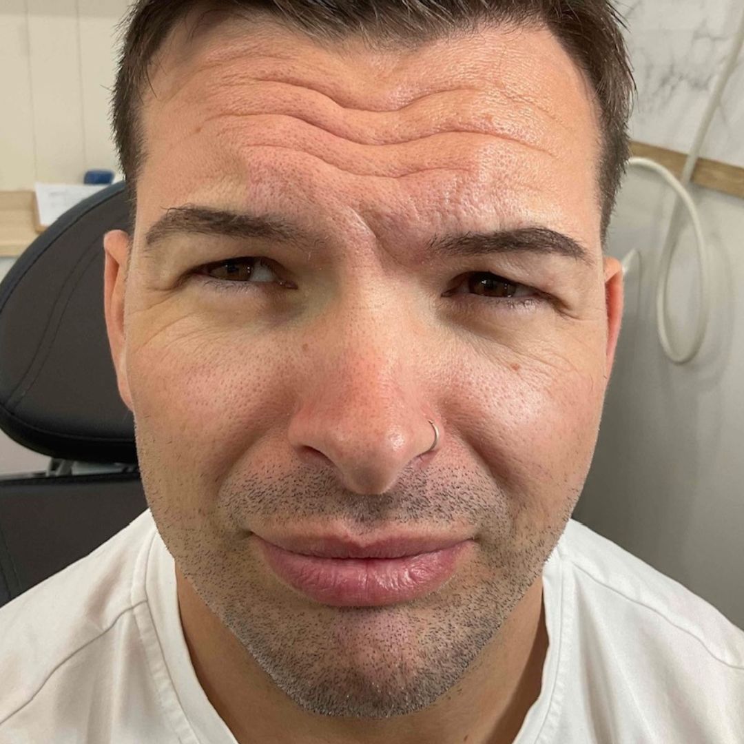 Male Anti-Wrinkle