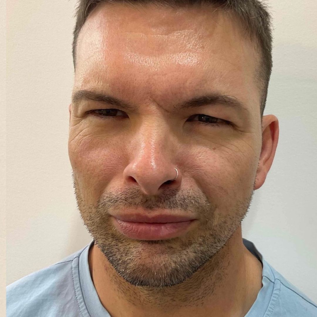 Male Anti-Wrinkle