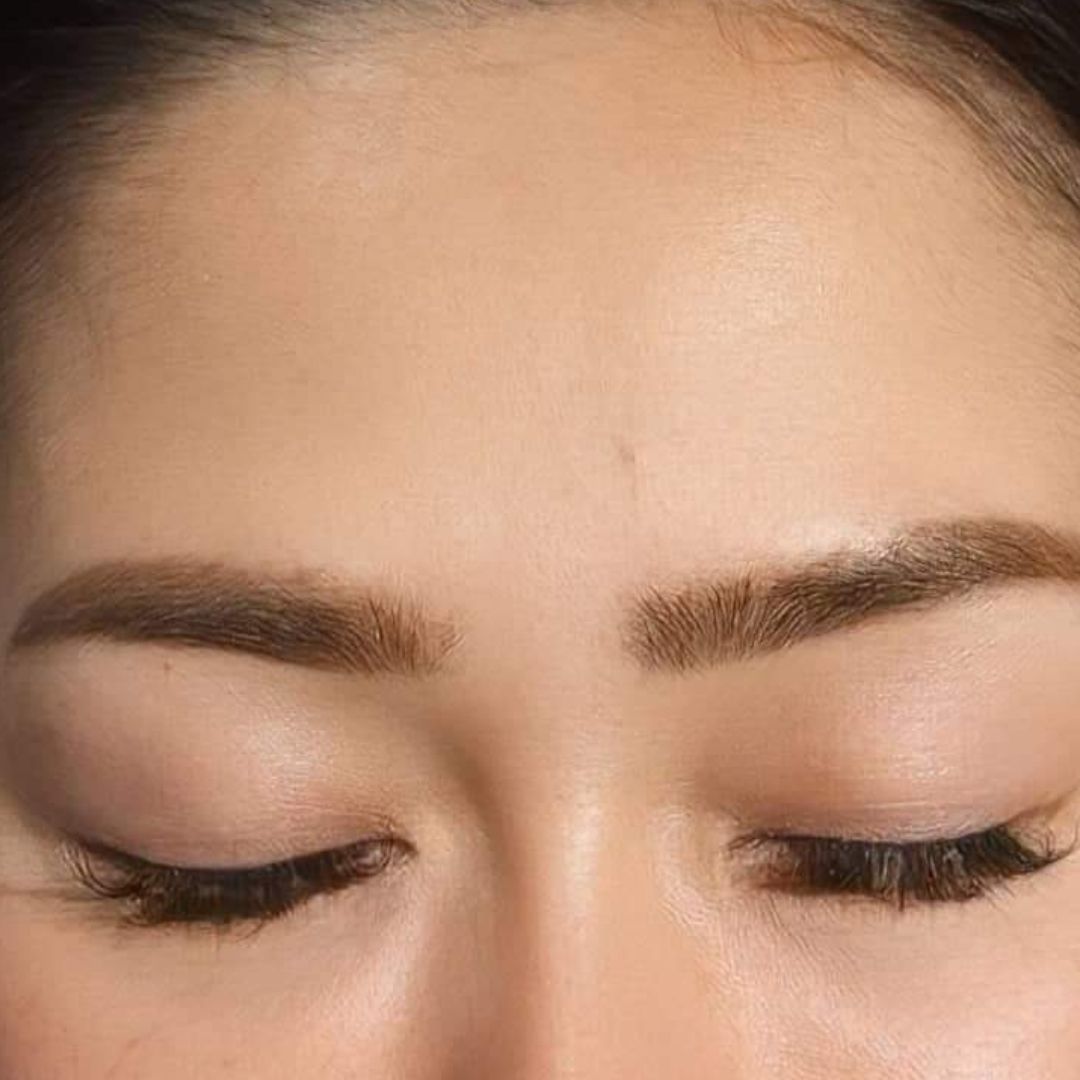 Female Anti-Wrinkle