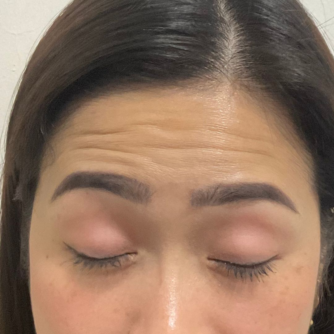 Female Anti-Wrinkle
