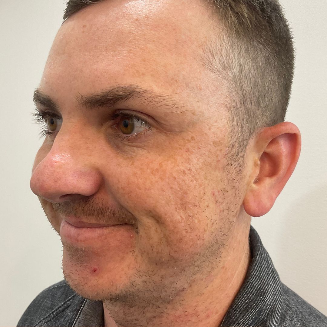 Male Anti-Wrinkle