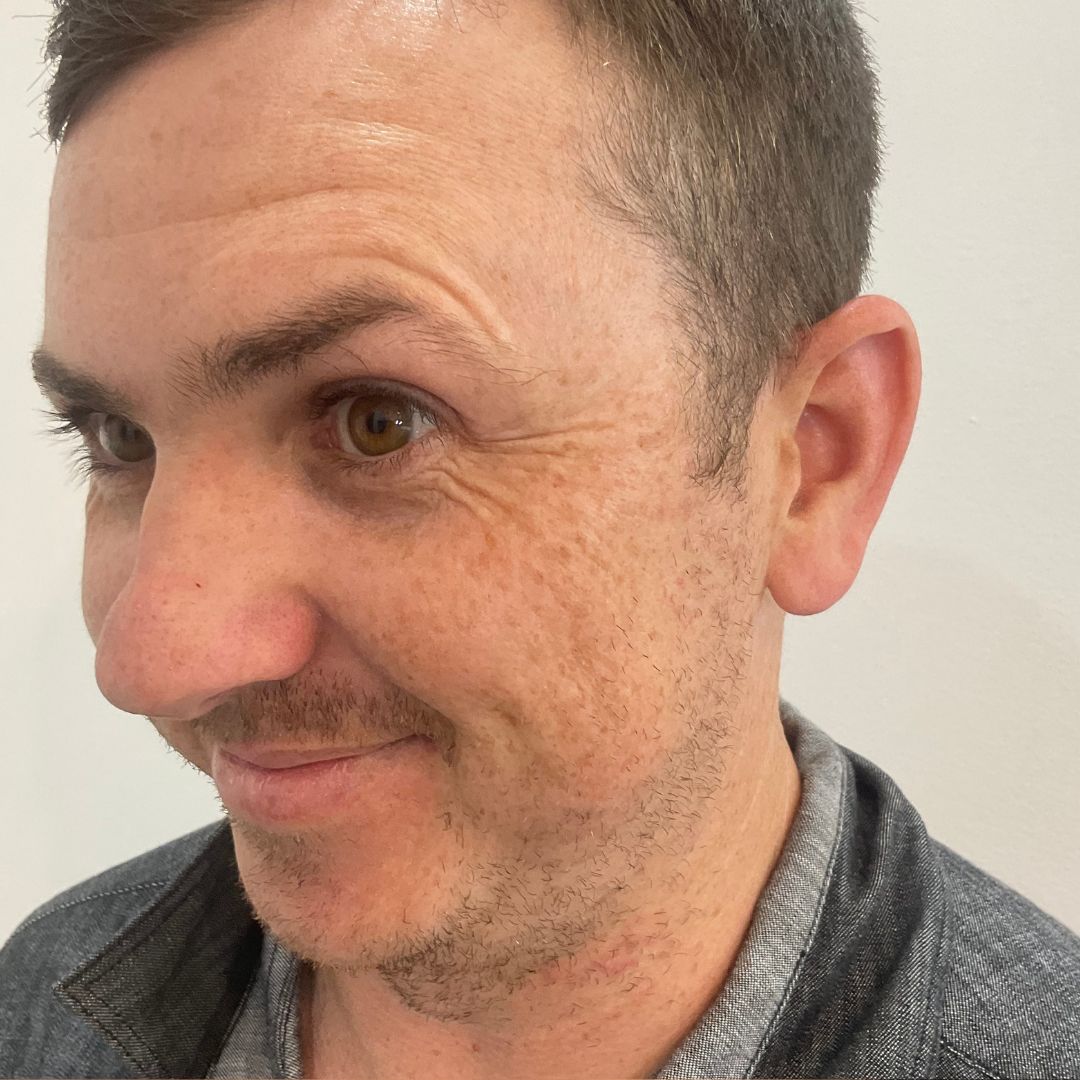 Male Anti-Wrinkle