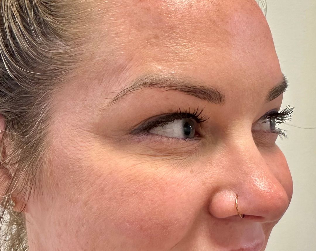 Anti-Wrinkle