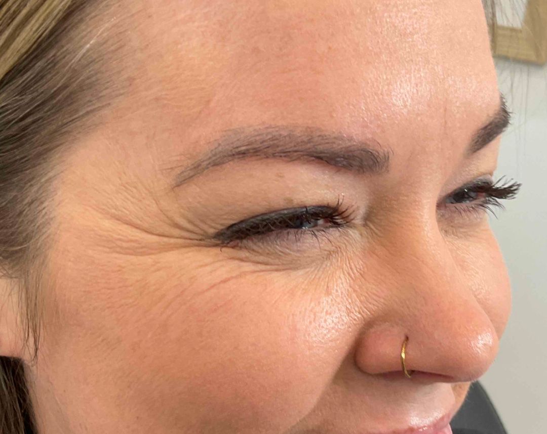Anti-Wrinkle